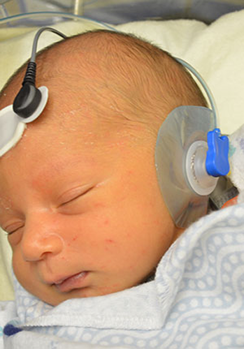 A newborn has two small monitors with connecting wires placed on its forehead and ear as it receives a hearing screening.